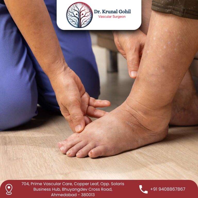 Diabetic Foot Treatment Dr. Krunal Gohil 768x768