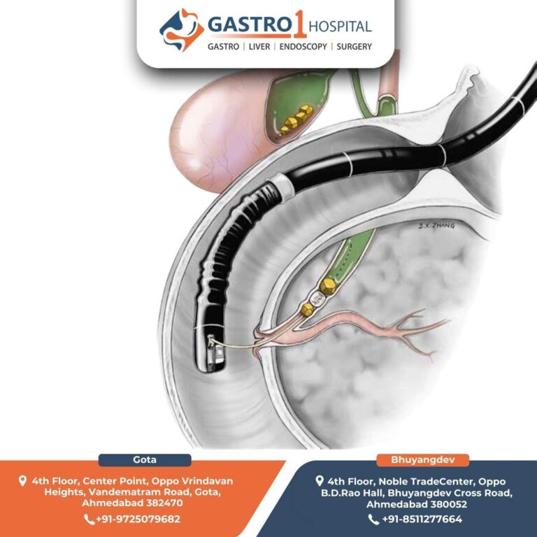 ERCP Doctor Gastro1 Hospital 768x768