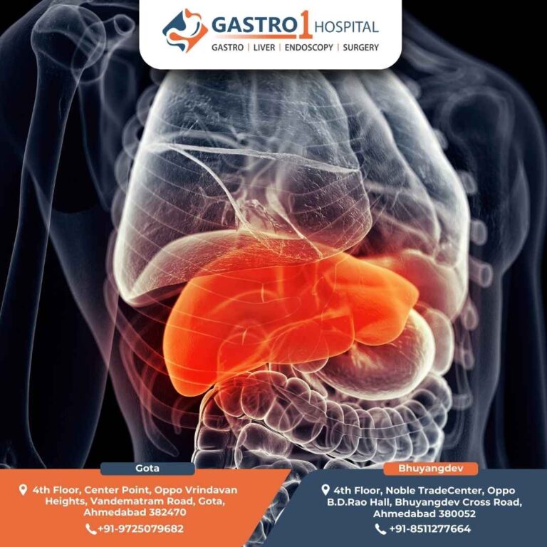Fibroscan Liver Test Gastro1 Hospital 768x768