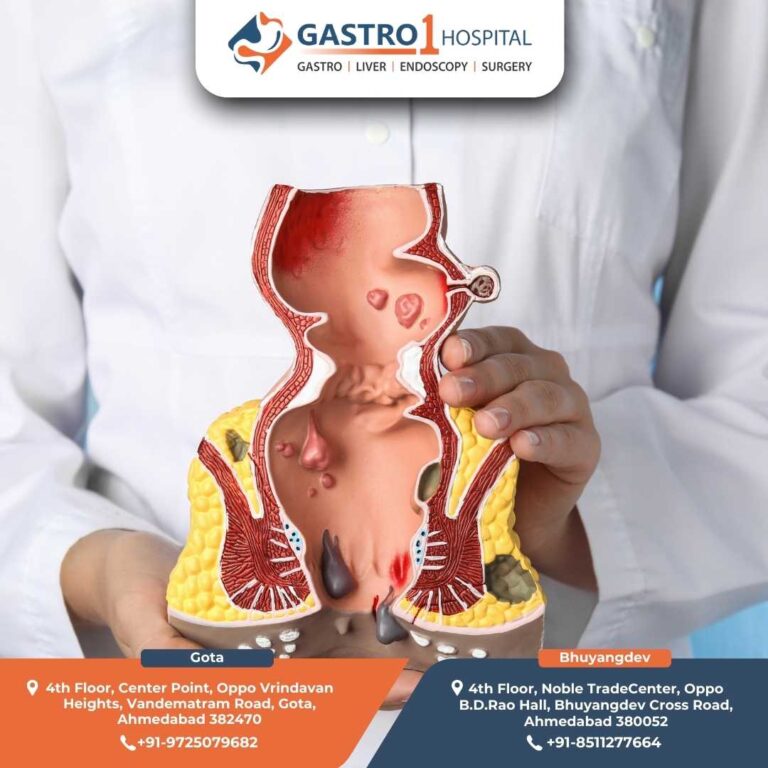 Fissure Doctor Gastro1 Hospital 768x768