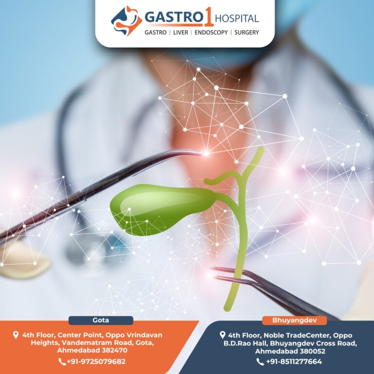 Gallbladder Stone Removal Gastro1 Hospital 768x768