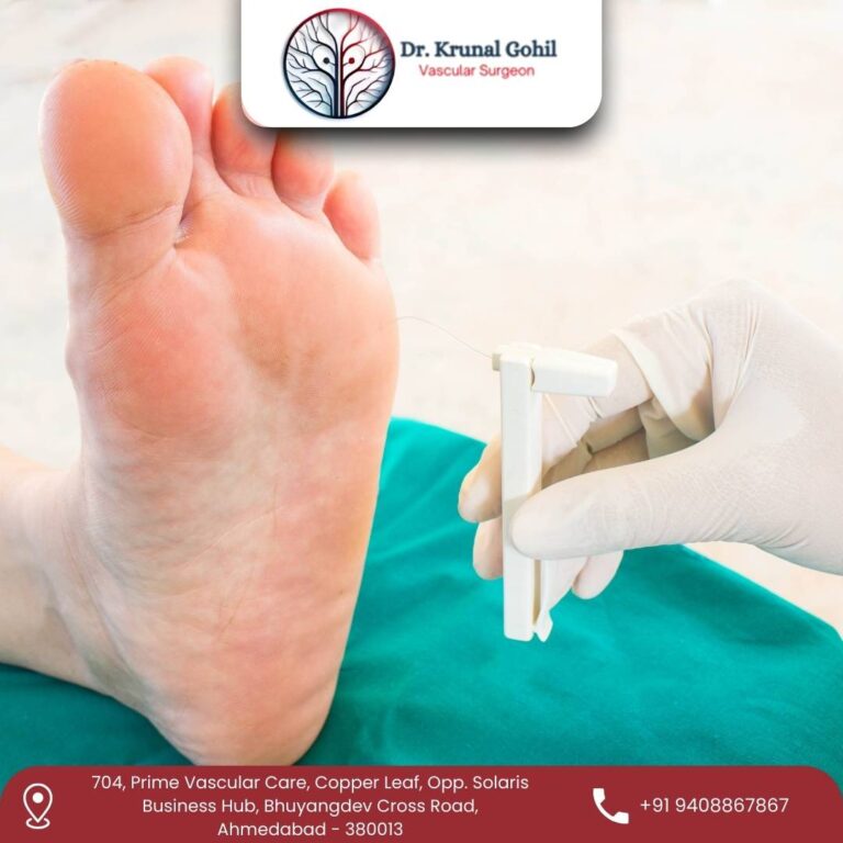 Gangrene Treatment Dr. Krunal Gohil 768x768