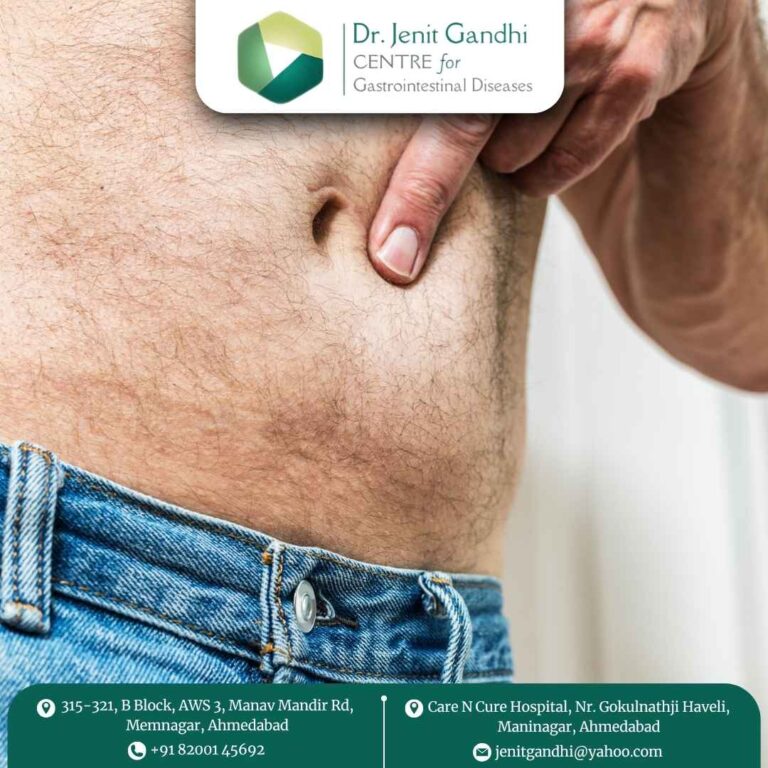 Hernia Surgeon Dr. Jenit Gandhi 768x768