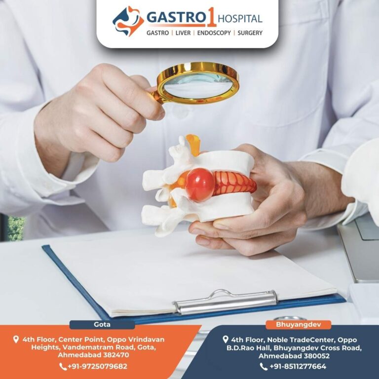 Hernia Surgery Gastro1 Hospital 768x768