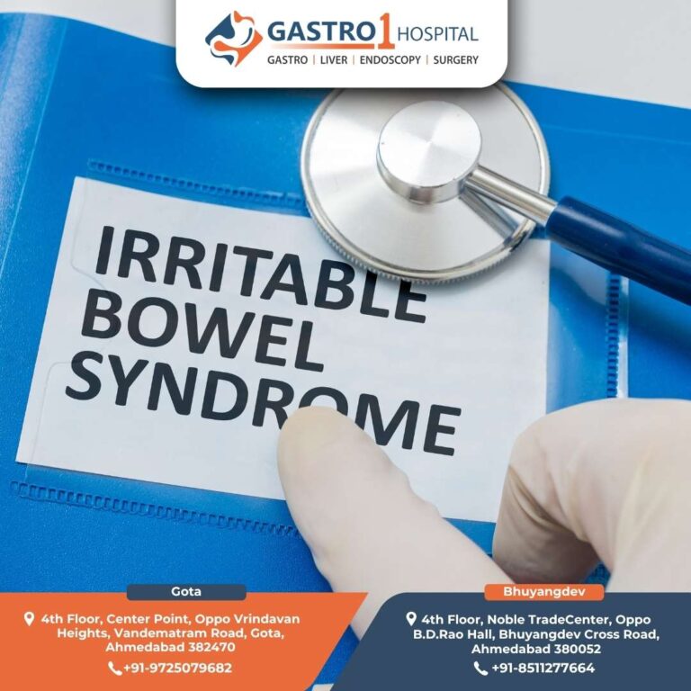 Irritable Bowel Syndrome Gastro1 Hospital 768x768