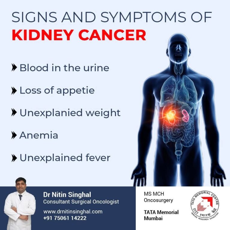 Kidney Cancer Treatment in Ahmedabad 768x768