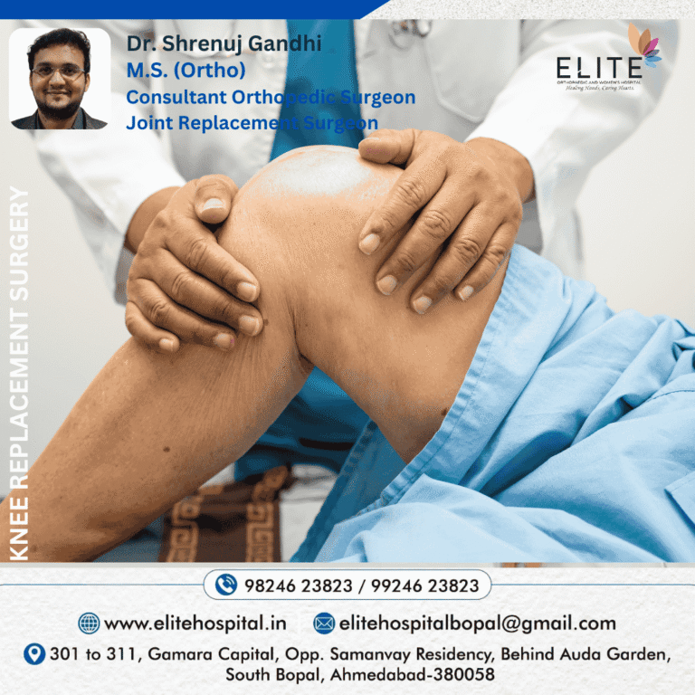 Knee Replacement  768x768