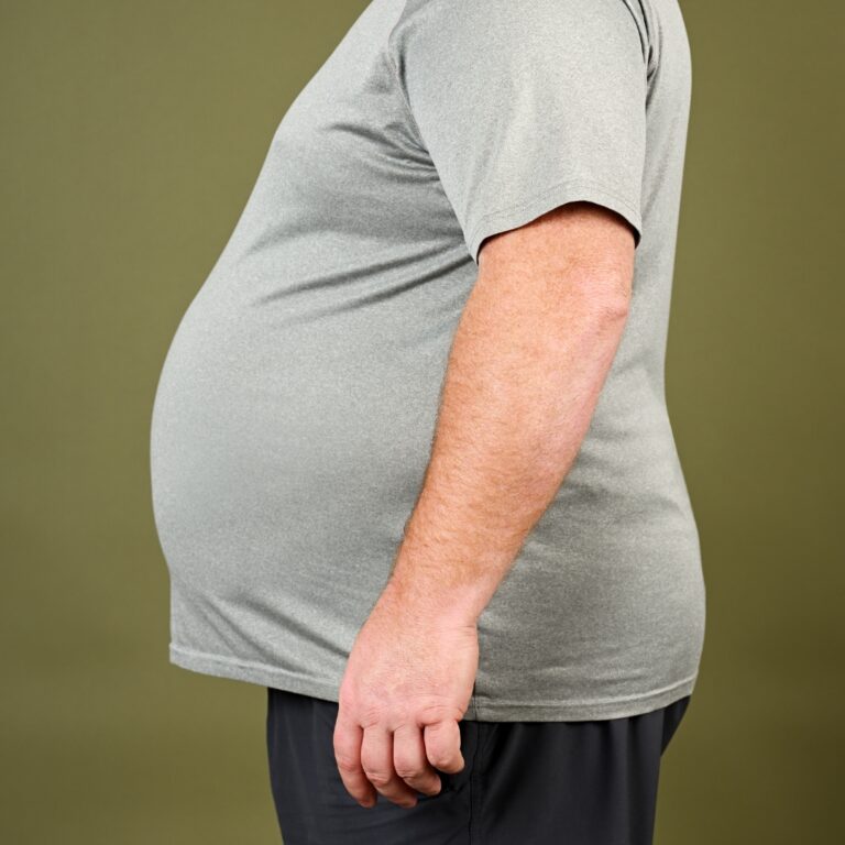 Obesity Surgeon in India 768x768