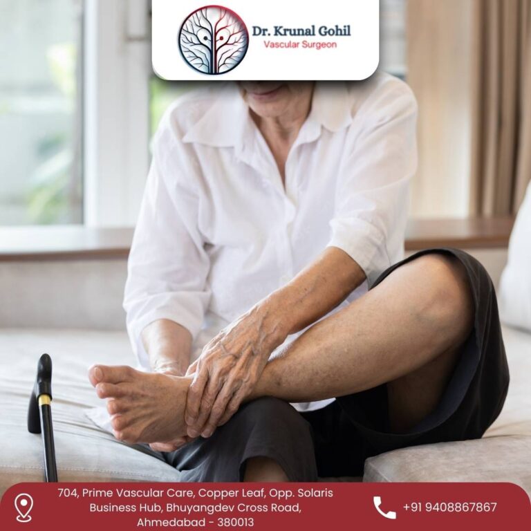 Peripheral Arterial Disease Treatment Dr. Krunal Gohil 768x768