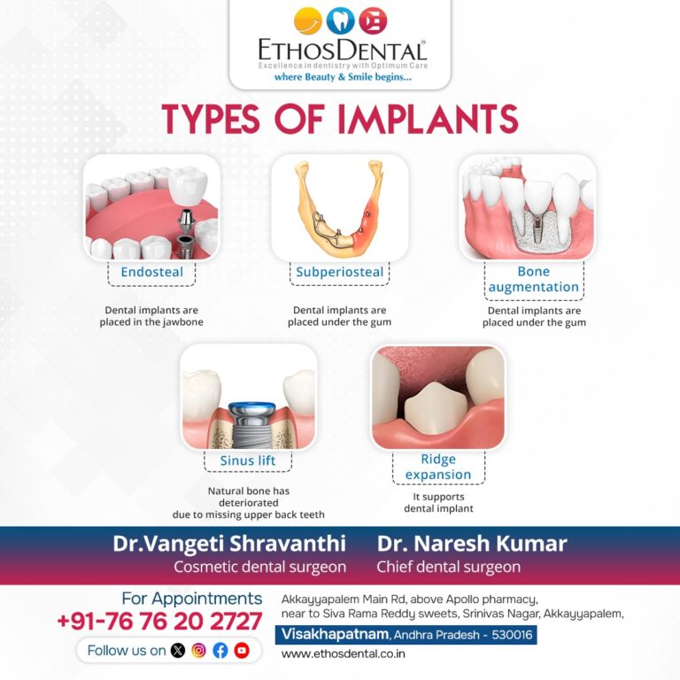 ethos vizag 2 768x768