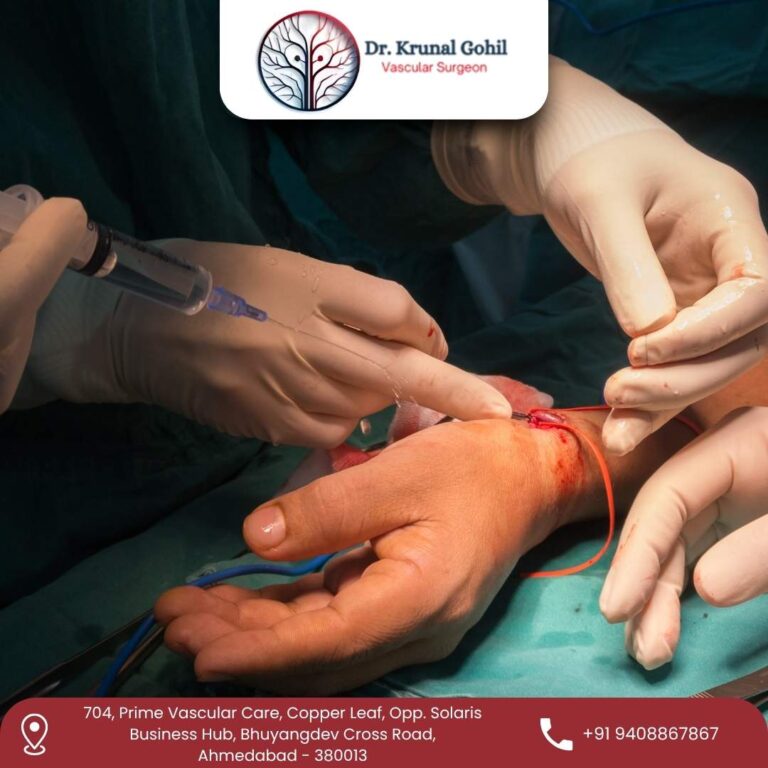 AV Fistula Surgery Dr. Krunal Gohil 768x768