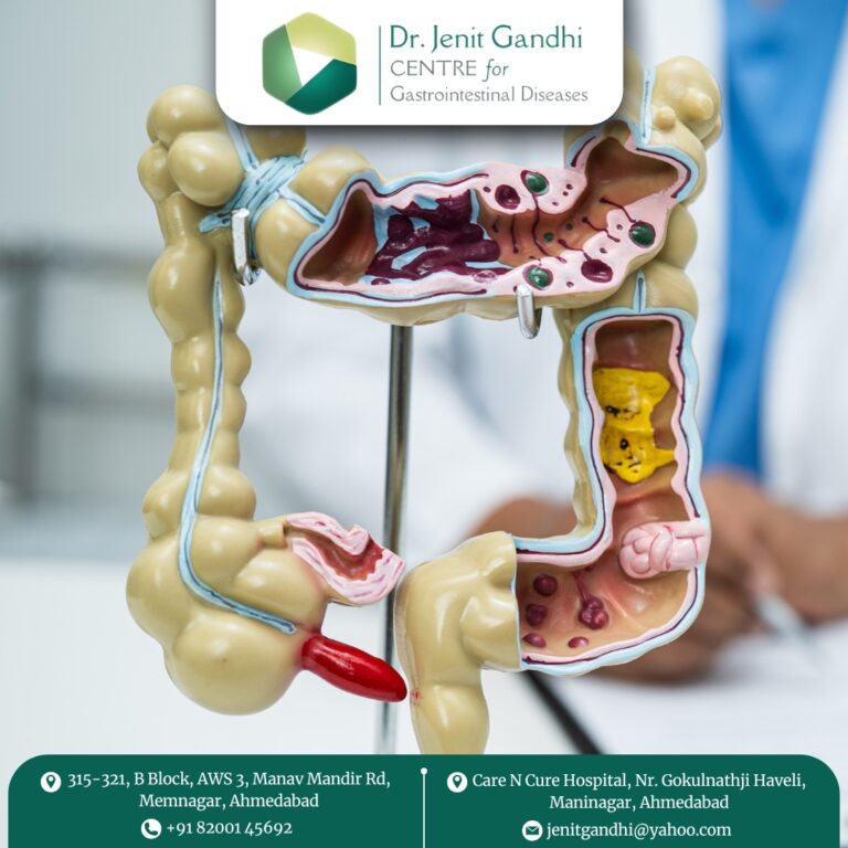 Appendix Surgeon Dr. Jenit Gandhi 768x768