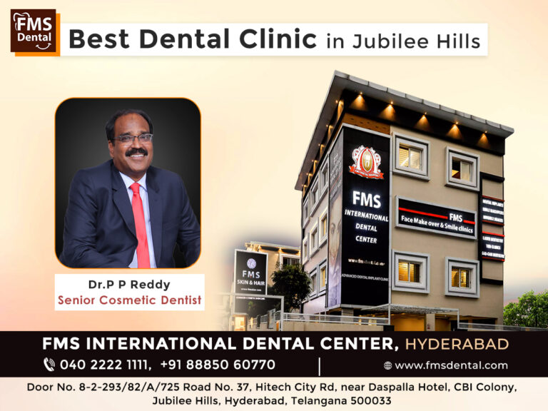 Best dental clinic in hyderabad 2 768x576