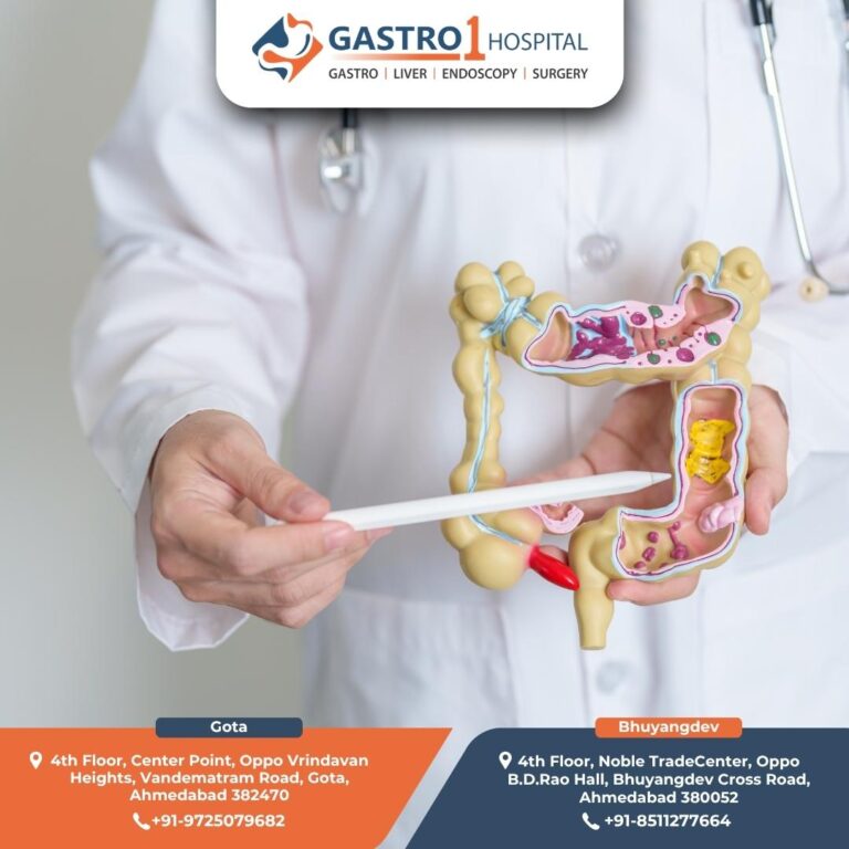 Colon Cancer Treatment Gastro1 Hospital 768x768