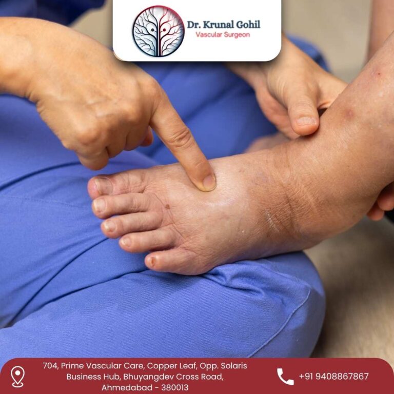 Diabetic Foot Treatment Dr. Krunal Gohil 768x768