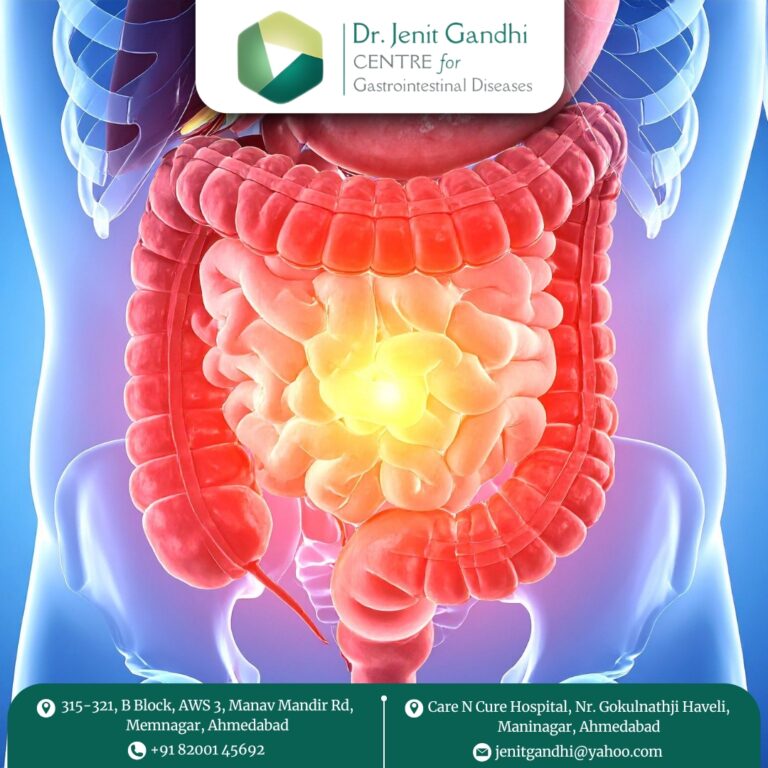 Gastro Surgeon Dr. Jenit Gandhi 768x768