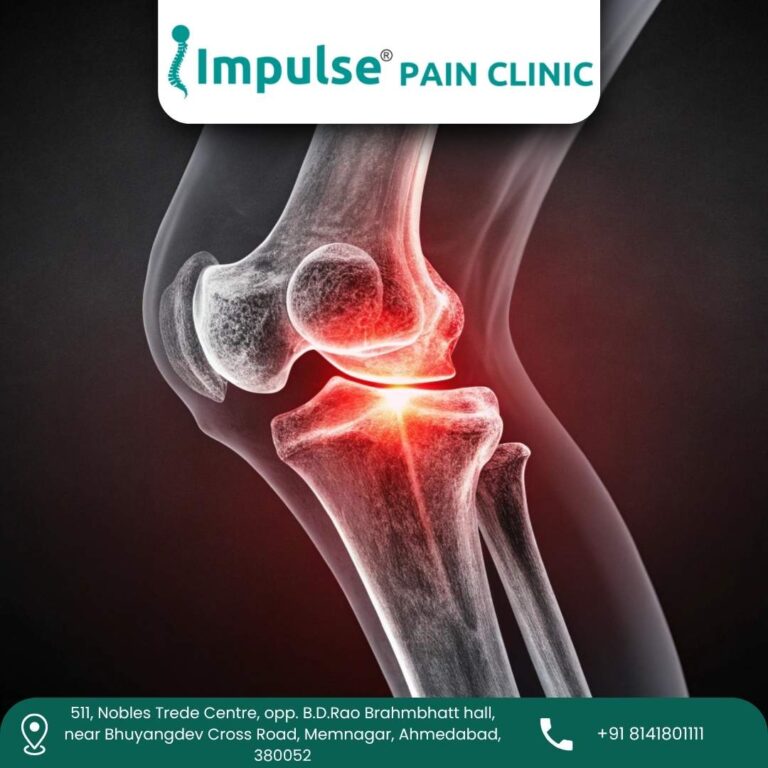 Knee Pain Impulse Pain Clinic 768x768