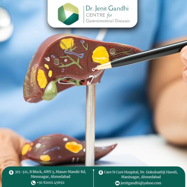 Liver Cancer Treatment Dr. Jenit Gandhi 768x768