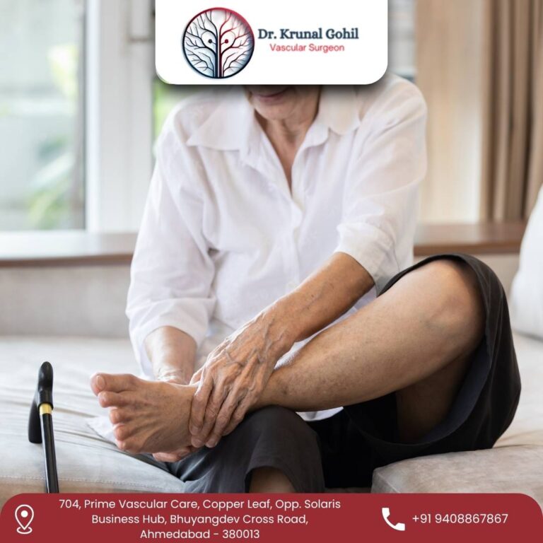Peripheral Arterial Disease Treatment Dr. Krunal Gohil 768x768
