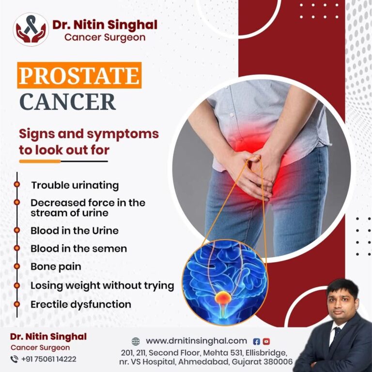 Prostate Cancer Surgeon in Ahmedabad 768x768