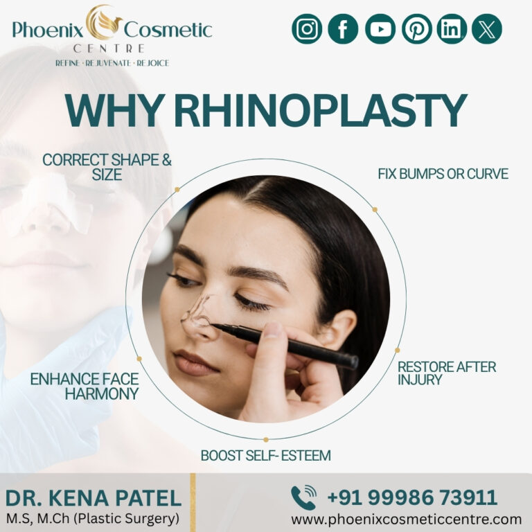 Rhinoplasty in Ahmedabad 768x768