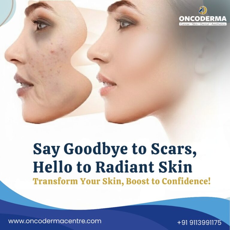 Say Goodbye to Scars Hello to Radiant Skin 768x768