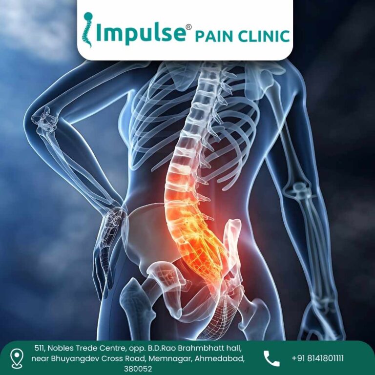 Sciatica Pain Treatment Impulse Pain Clinic 768x768