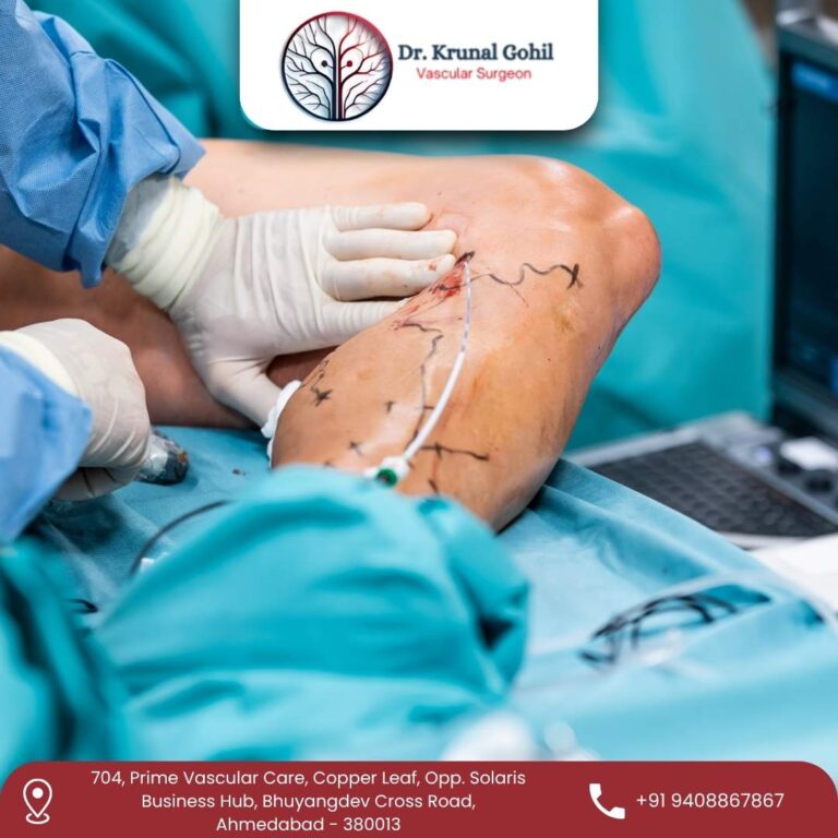 Vascular Surgeon Dr. Krunal Gohil 1 768x768