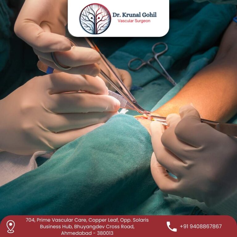 AV Fistula Surgeon Dr. Krunal Gohil 1 768x768