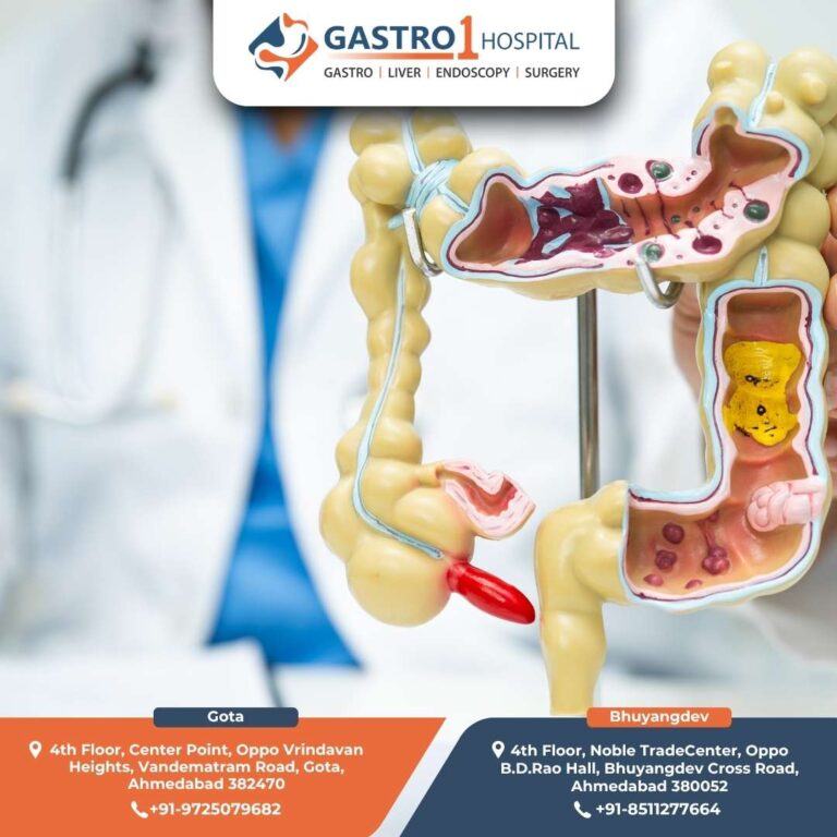 Appendix Gastro1 Hospital 768x768