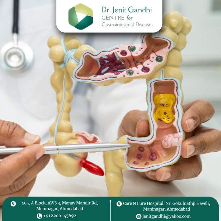 Appendix Surgeon Dr. Jenit Gandhi 768x768