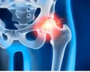 Copy of Untitled Design 1 1