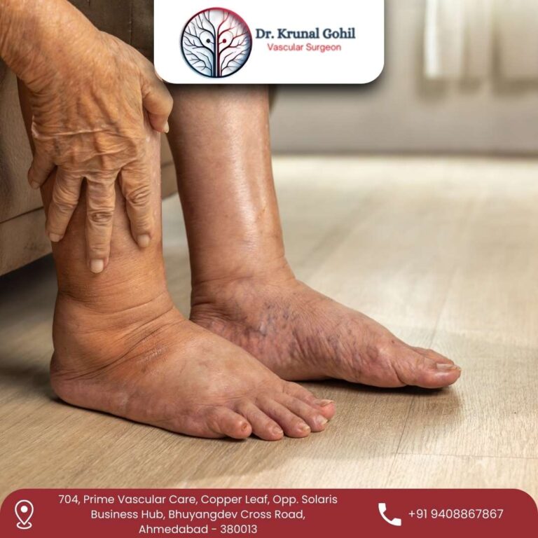 Diabetic Foot Treatment Dr. Krunal Gohil 1 768x768
