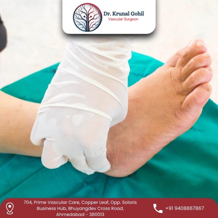 Gangrene Treatment Dr. Krunal Gohil 768x768