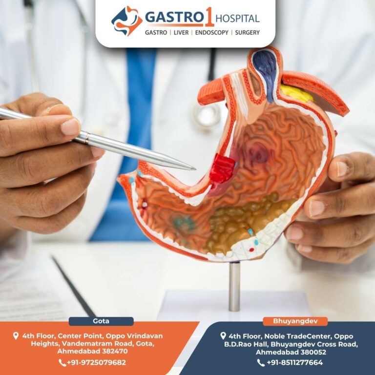 Gastrointestinal Cancer Gastro1 Hospital 768x768