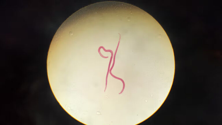 Worm infection 768x431