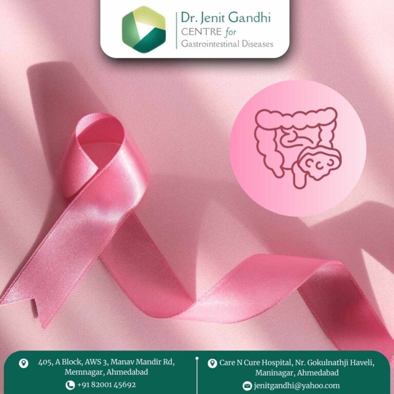 Colon Cancer Treatment Dr. Jenit Gandhi 768x768