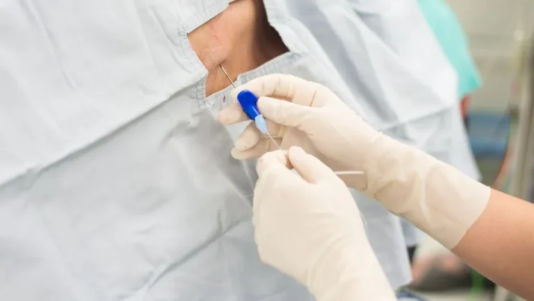 Epidural steroids inj 768x433