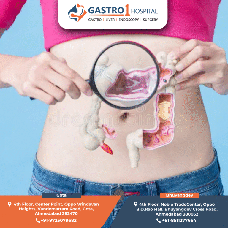 colon cancer treatment Gastro1 Hospital 768x768