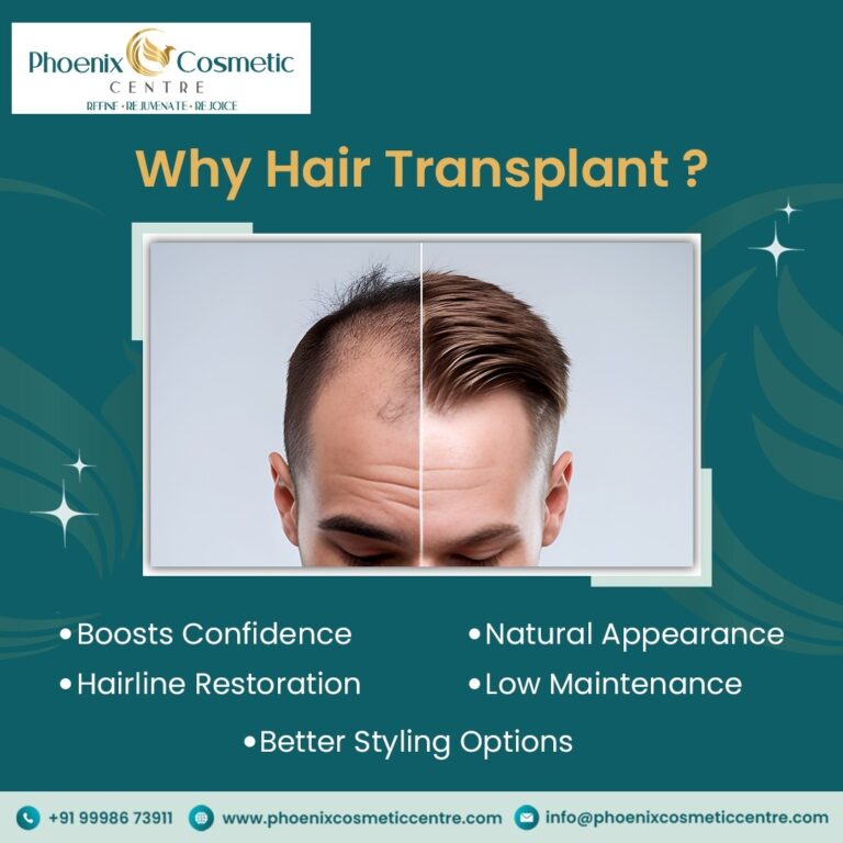 phoenix hair transplant 768x768