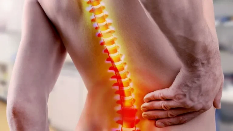 spinal cord stimulation 768x433