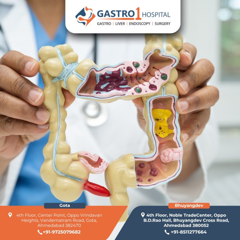 Appendix Doctor Gastro1 Hospital 768x768
