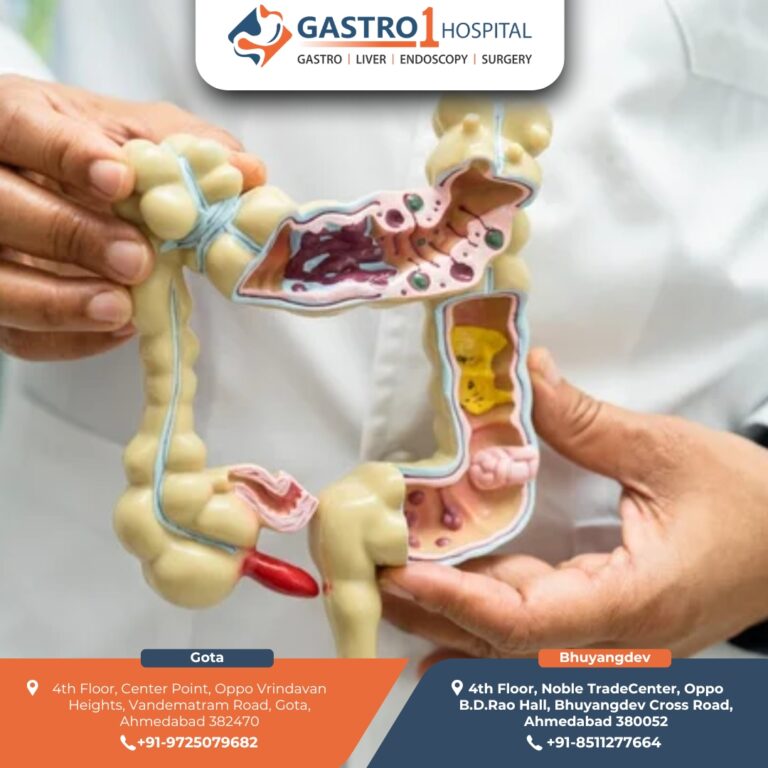 AppendixDoctorInAhmedabad Gastro1 Hospital 3 768x768