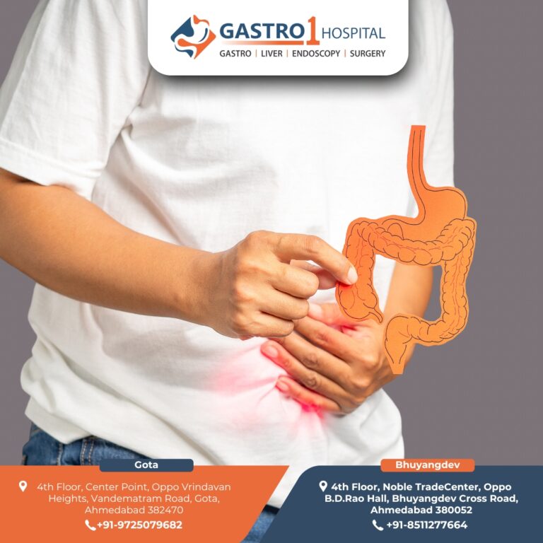 Best Gastrointestinal Cancer Clinic in Ahmedabad 768x768