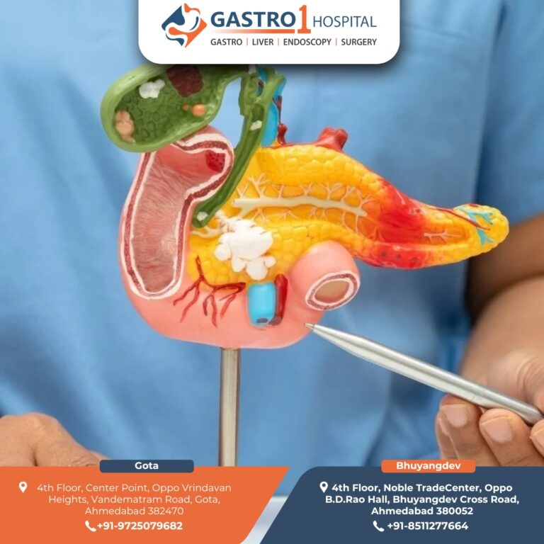 BestGallbladderStoneTreatment Gastro1 Hospital 3 768x768
