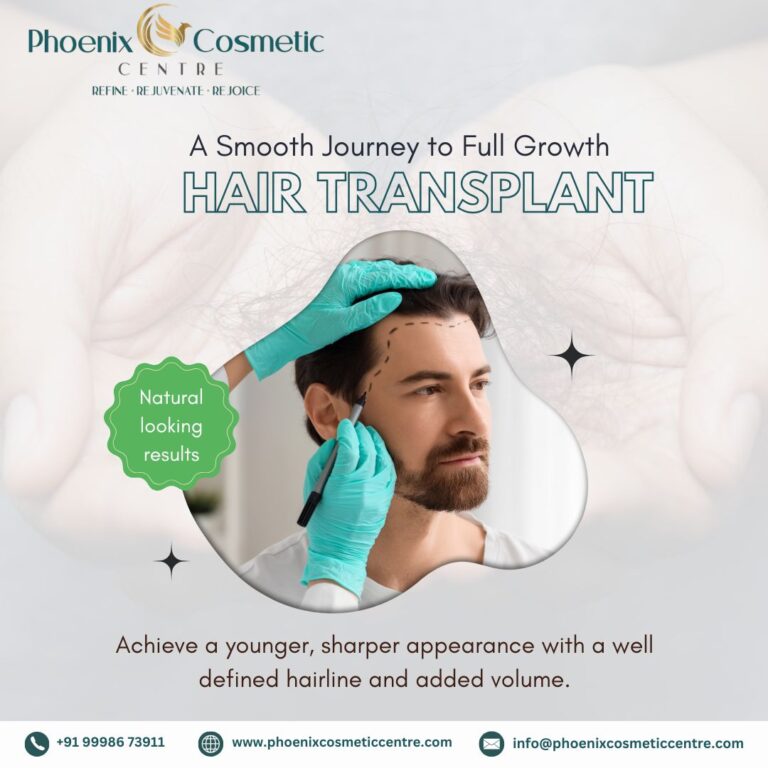 Hair Transplant Surgery in Ahmedabad2 768x768