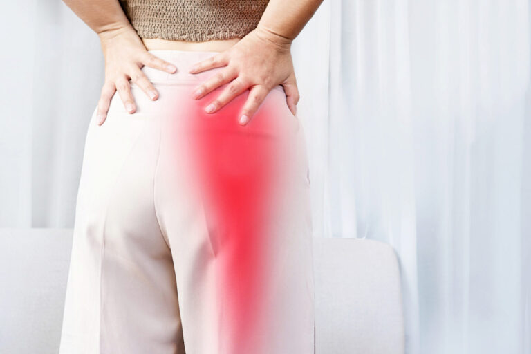 Sciatica Pain 768x512