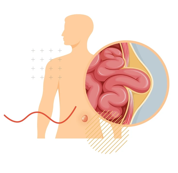 minimally bookmarking