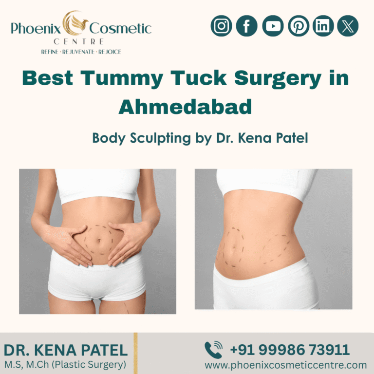 tummy tuck 768x768