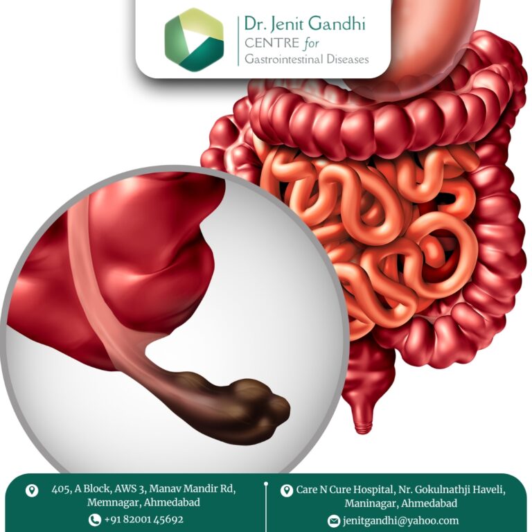 AppendixSurgeonInAhmedabad Dr Jenit Gandhi 768x768